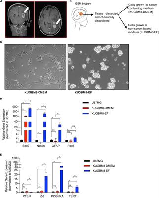 Drug Repositioning Screen on a New Primary Cell Line Identifies Potent Therapeutics for Glioblastoma